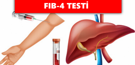 You are currently viewing FIB-4 Testi