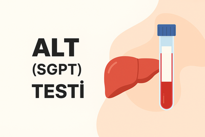haberler ALT (SGPT) TESTİ