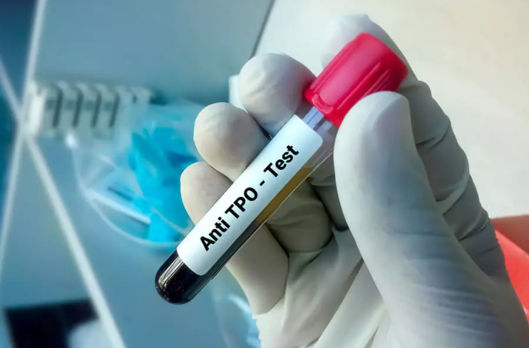 haberler Anti-TPO Testi