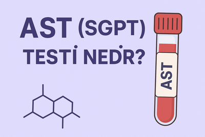 You are currently viewing AST (SGOT) TESTİ