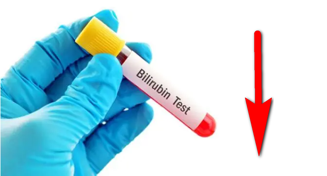 haberler Yüksek Bilirubin Seviyesini Nasıl Düşürürsün?