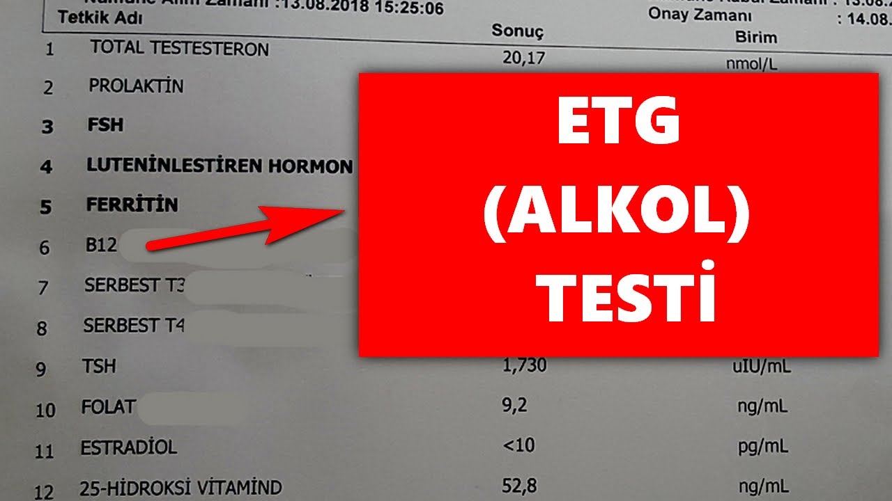 You are currently viewing ETG Testi Nedir? – Alkol Kullanımını Belirleyen Test Yöntemi